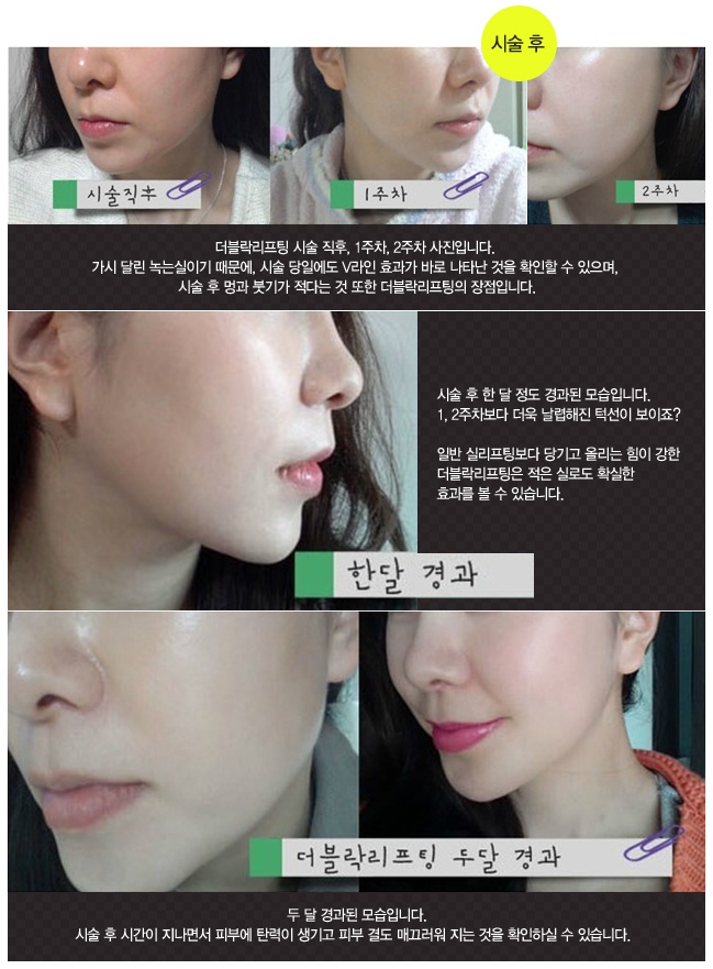 d1a73d84a1f1e8b2ba125f620b22395e_1763102194_9129.jpg d1a73d84a1f1e8b2ba125f620b22395e_1763102194_9129.jpg